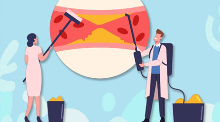 혈관 건강을 위한 습관