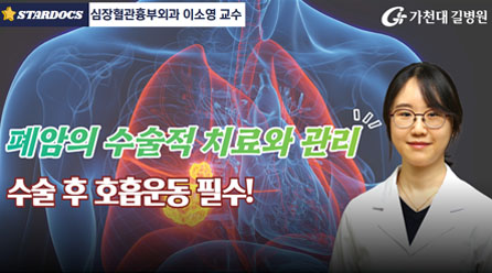 폐암 수술 치료와 관리