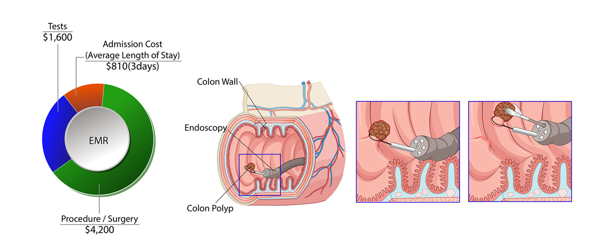 Colorectal Cancer 01