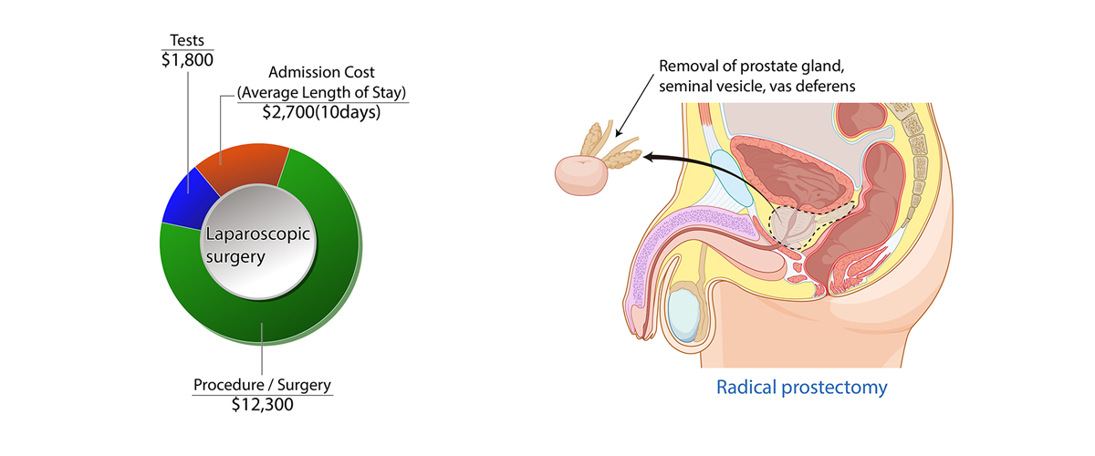 Prostate Cancer