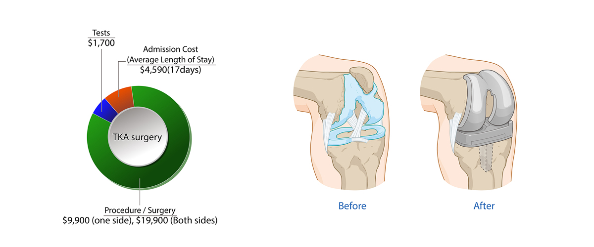 Knee joint