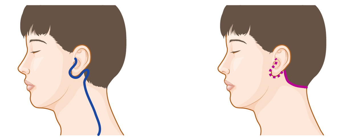 Otorhinolaryngology