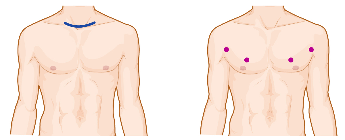 Thyroid diseases