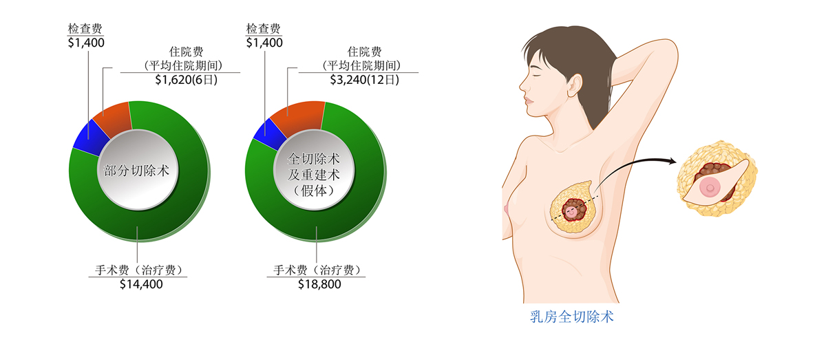 乳腺癌