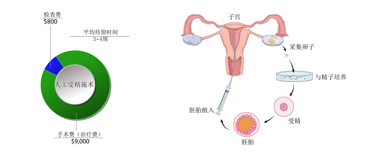 IVF