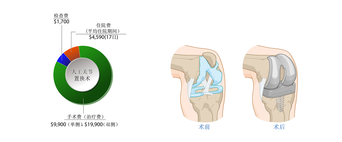 膝关节