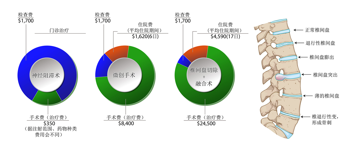 脊柱