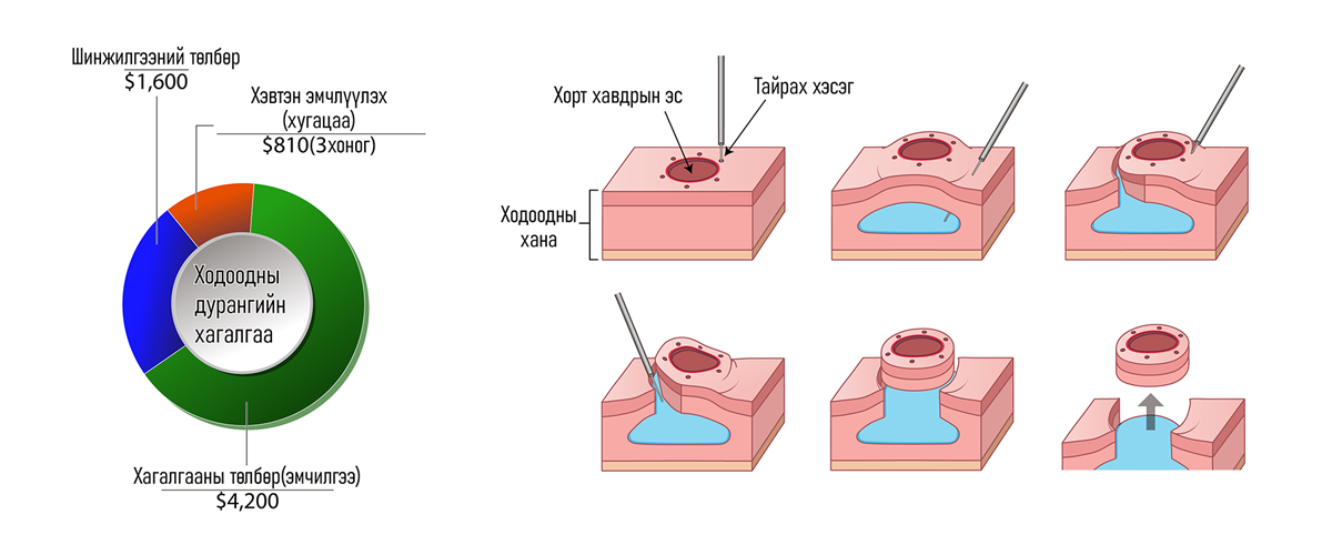 Ходоодны хавдар