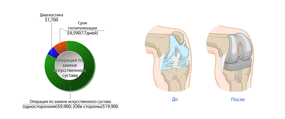 Коленный сустав