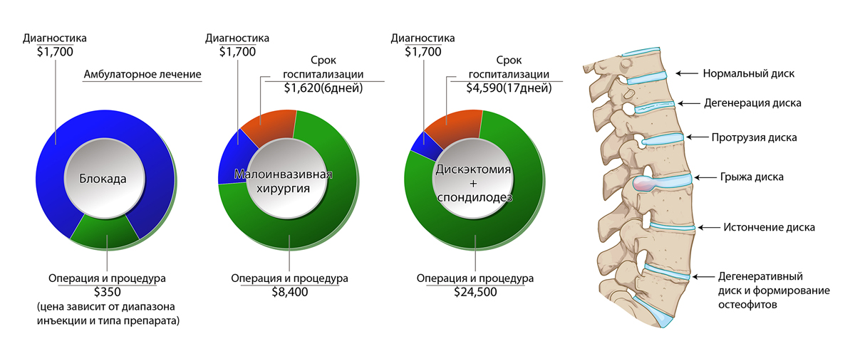 Позвоночник