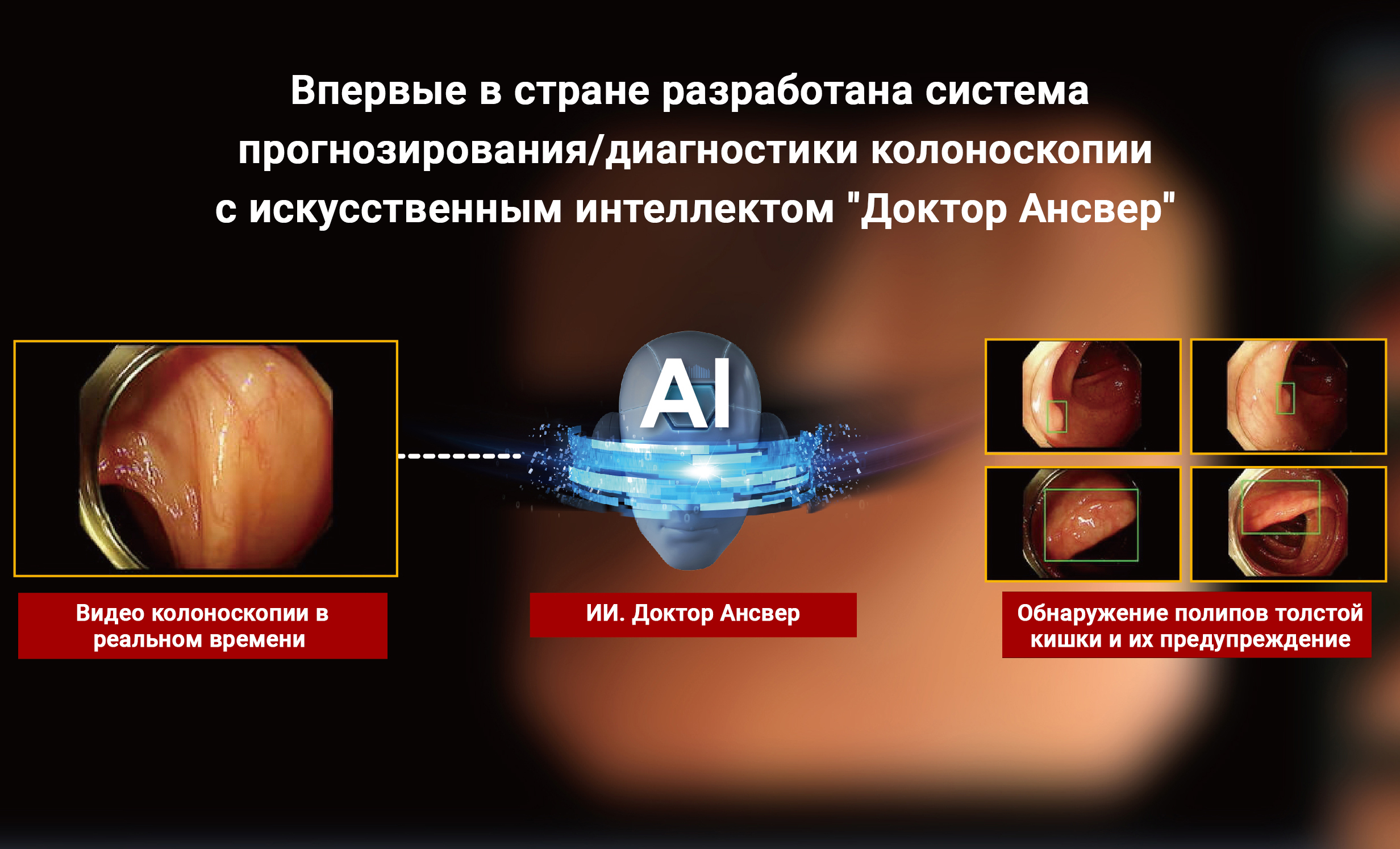 Впервые в стране разработана система прогнозирования/диагностики колоноскопии с ИИ. Доктор Ансвер