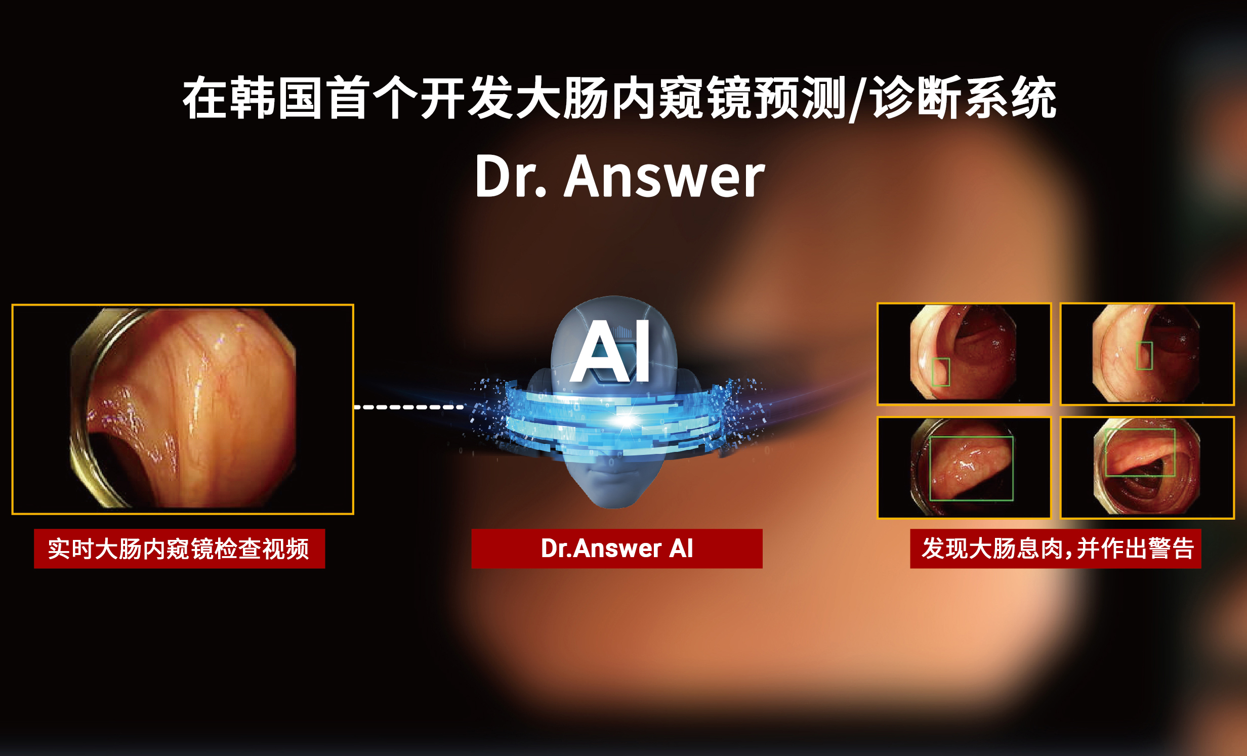 在韩国首个开发大肠内窥镜预测/诊断系统(Dr. Answer)