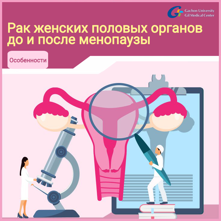 Особенности рака женских половых органов до и после менопаузы