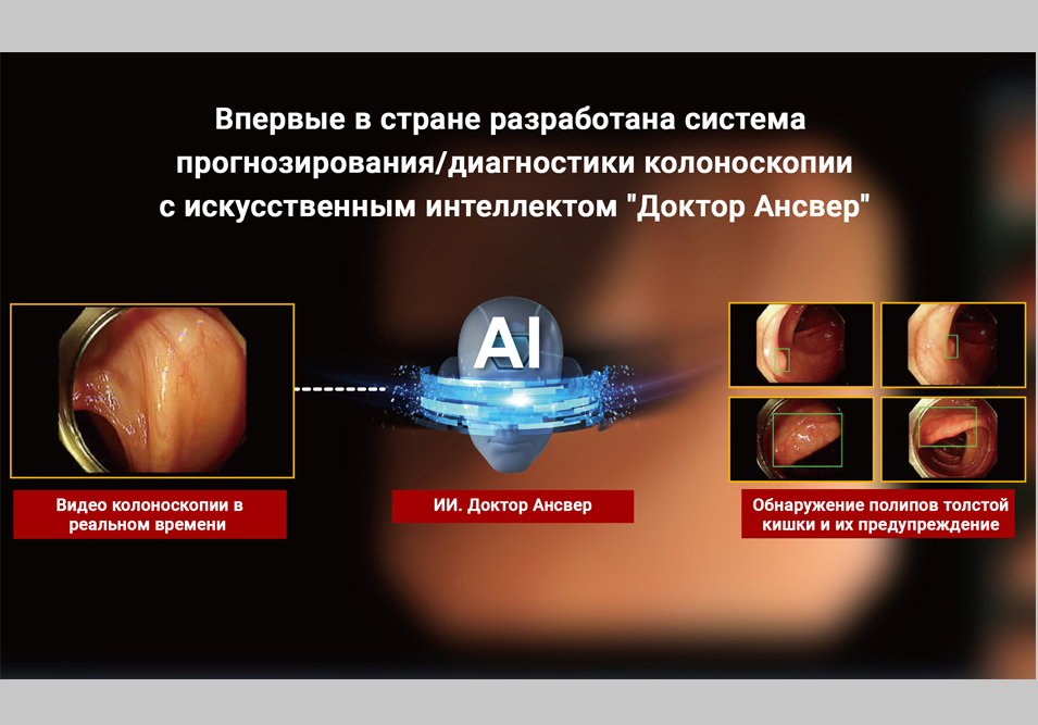 Впервые в стране разработана система прогнозирования/диагностики колоноскопии с ИИ. Доктор Ансвер